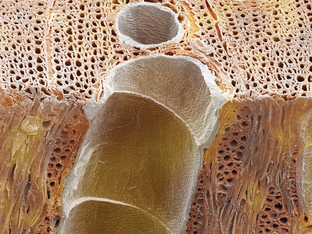 biomassa-microscopico 150414